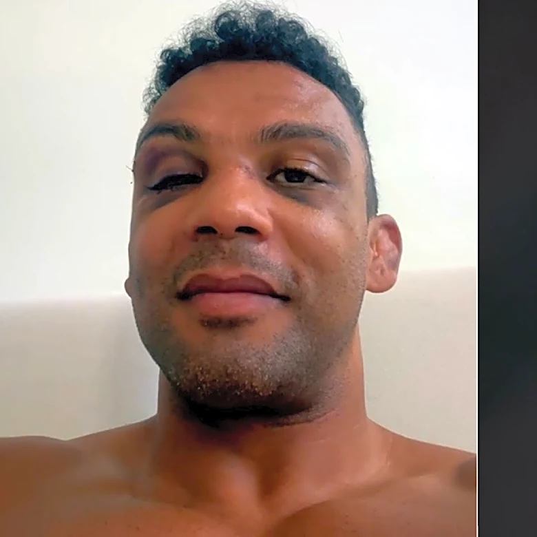 Edson Barboza details grim reason for UFC retirement: 'I almost lost my vision'