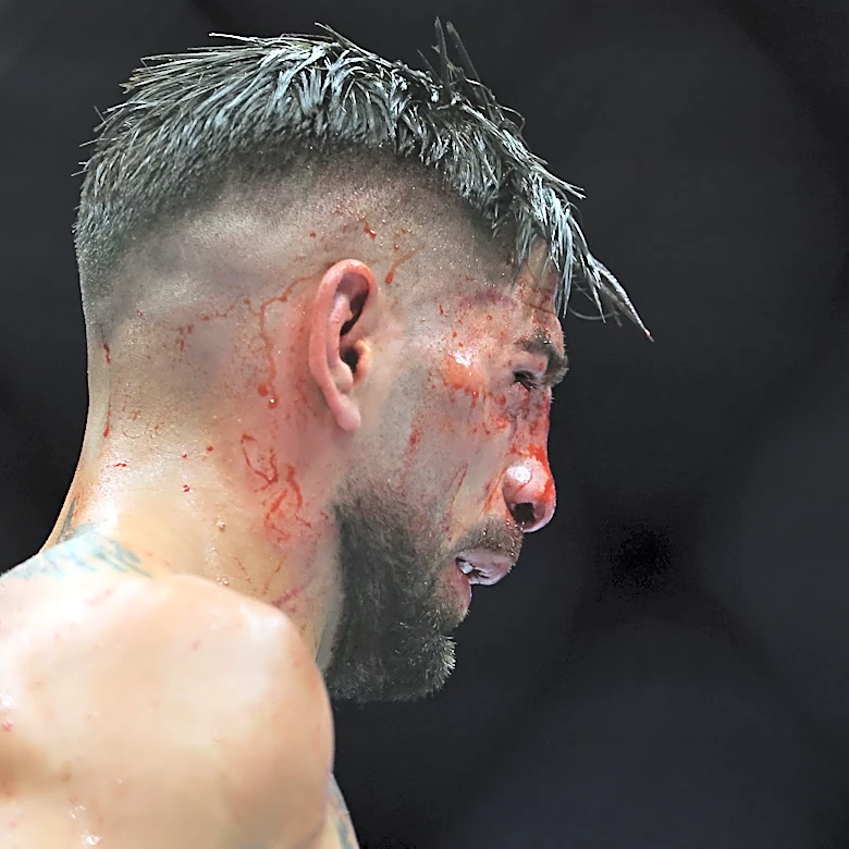 Arman Tsarukyan suggests 'easy fight' for Ilia Topuria after UFC title loss
