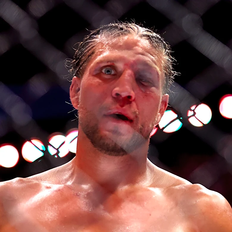 Brian Ortega releases UFC 331 withdrawal statement, shares injury: 'This one hurts'