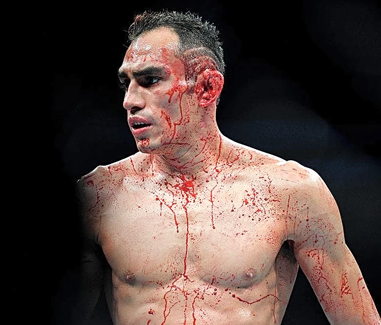 Tony Ferguson emotional over Misfits Boxing win after mother's death