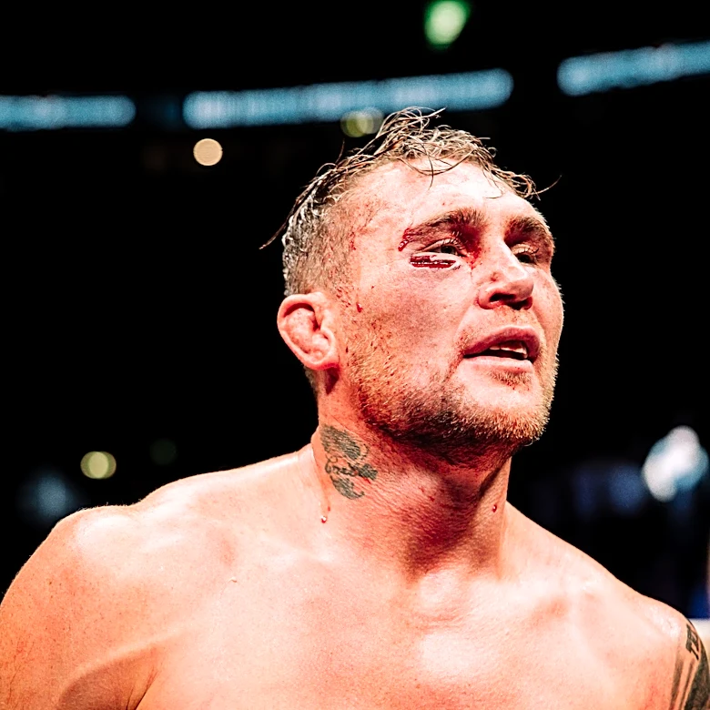 Darren Till: BKFC fight vs. fellow UFC veteran would sell out stadium