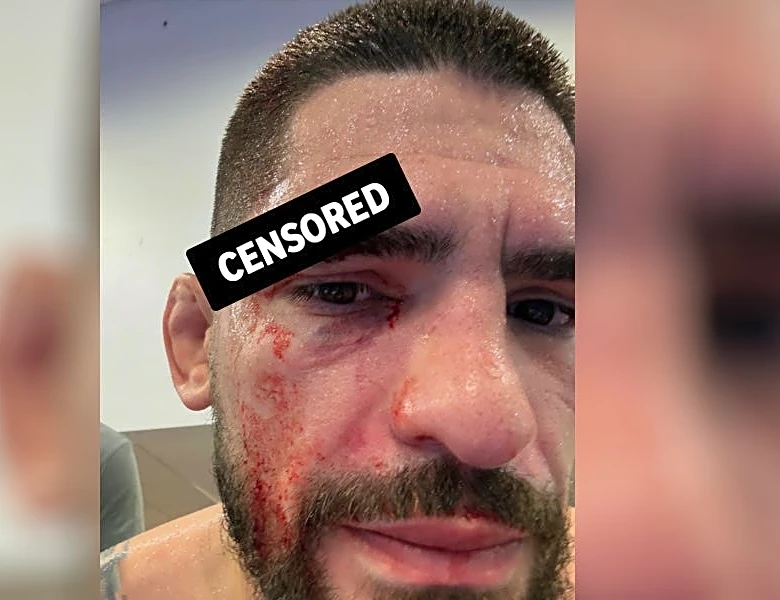 New UFC fight booked for Halloween card after grisly cut