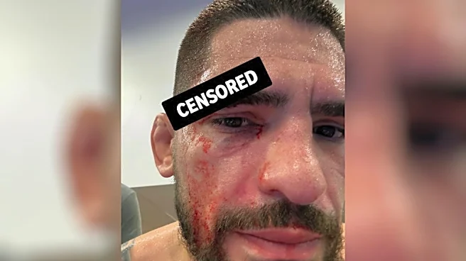 New UFC fight booked for Halloween card after grisly cut