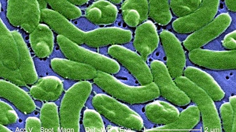 Palm Beach County 'flesh-eating bacteria' total holds steady