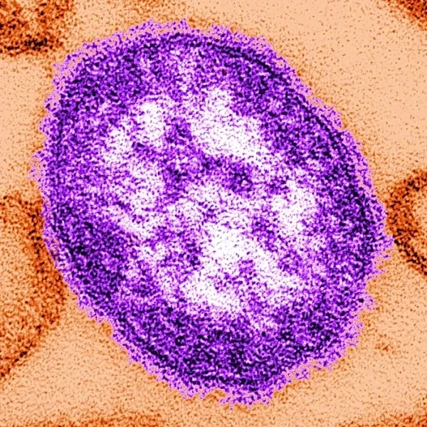 Measles exposure reported on 6 Amtrak routes across California