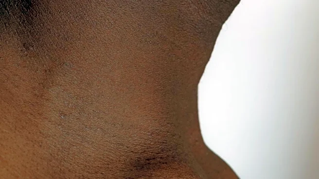 University of Utah Researchers Investigate Ozempic's Impact on Muscle Mass