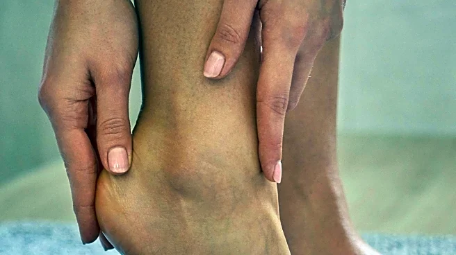 Nomogram Model Assesses Risk Factors for Deep Vein Thrombosis in TBI Patients