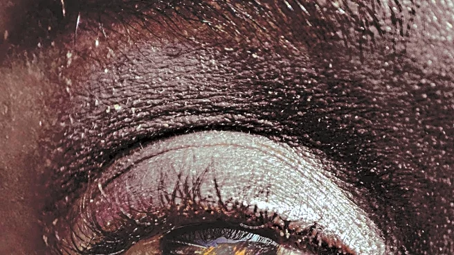 Plastic Surgeons Warn Against Dangerous 'Hunter Eye' Surgery