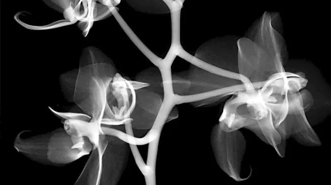 Study Reveals X-rays Influence Arthritis Patients Towards Surgery