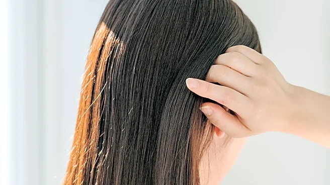Oily Scalp Linked to Potential Hair Loss: Expert Advice on Prevention