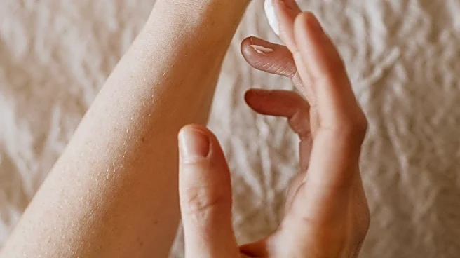 Advancements in Psoriasis Treatment Offer New Hope for Patients