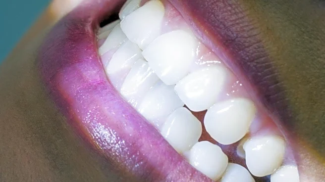Study Links Oral Bacteria to Increased Risk of Heart Attack