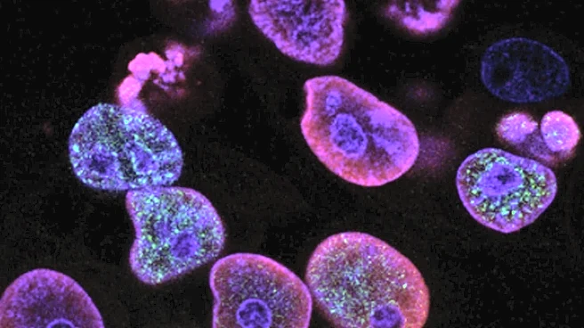 Study Reveals Mechanism of Chemoresistance in Gastric Cancer Linked to Fibroblast-Derived GAS6