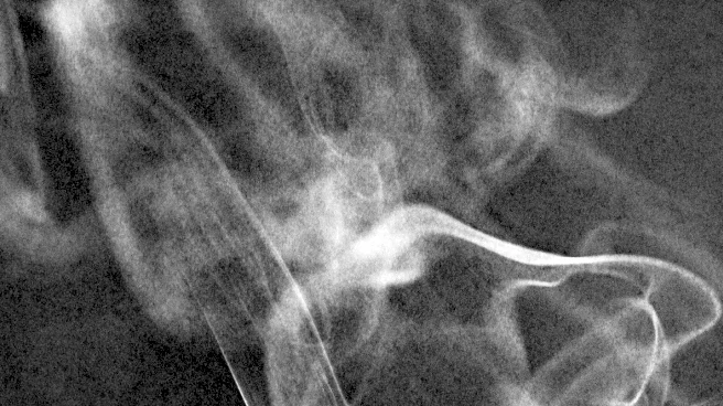 Dear Abby Advocates for Smoking Cessation and Personal Support