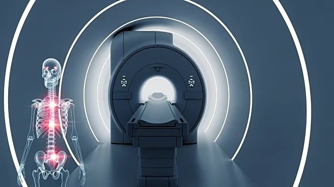 Whole-Body MRI Reveals Disease Pattern Changes in Multiple Myeloma Patients