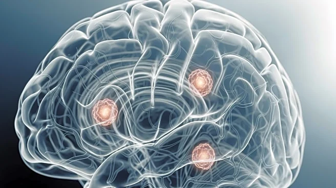 Study Links Cerebral Amyloid Angiopathy to Quadrupled Dementia Risk in Older Adults