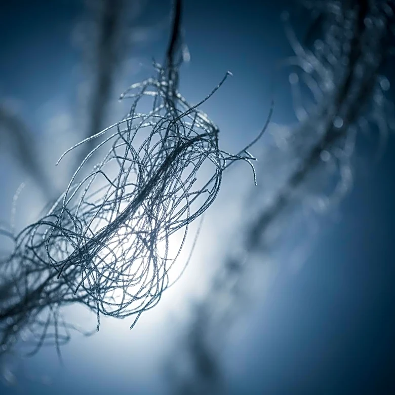 Cochrane Review Finds Limited Benefit in Alzheimer's Amyloid Drugs