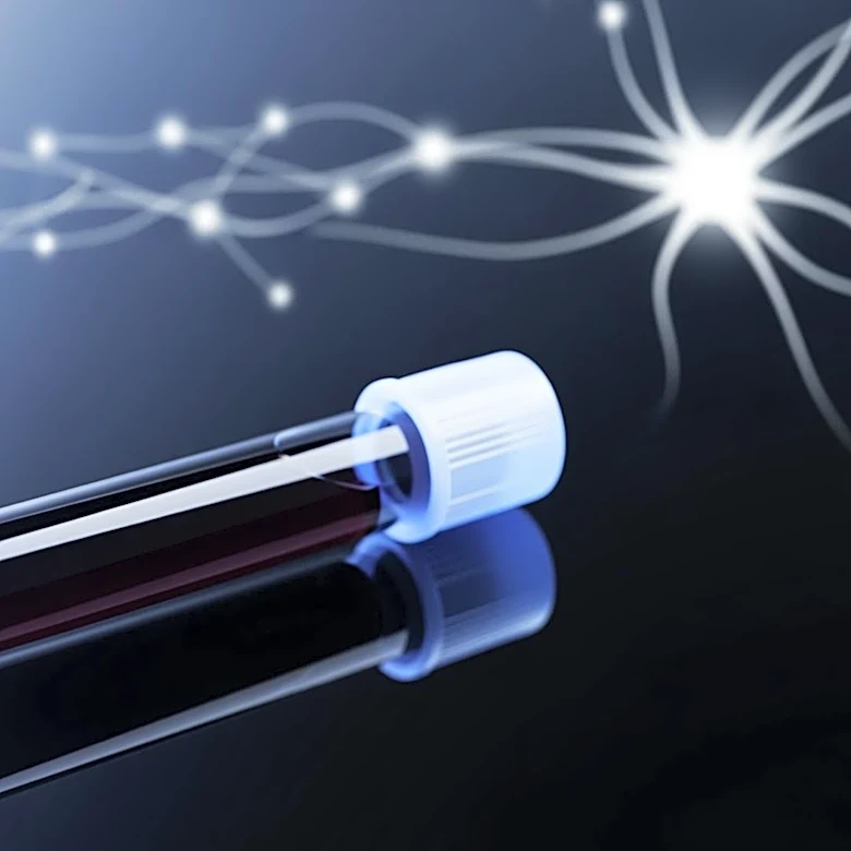 Mass General Brigham Researchers Identify Blood Test for Early Alzheimer's Detection