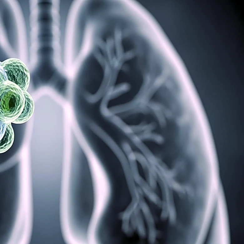 FIU Researchers Discover HIV Protein Disrupts Lung Function, Increasing COPD Risk