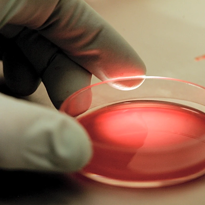 Study Reveals PSA Levels May Not Accurately Reflect Prostate Cancer Progression