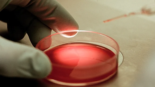 Study Reveals PSA Levels May Not Accurately Reflect Prostate Cancer Progression