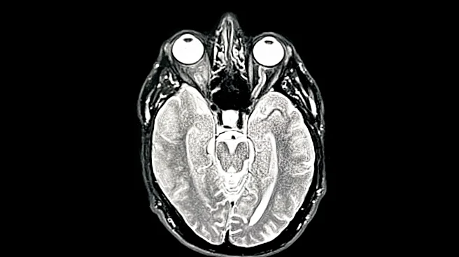Research Identifies Mechanism Limiting Brain Repair After Stroke