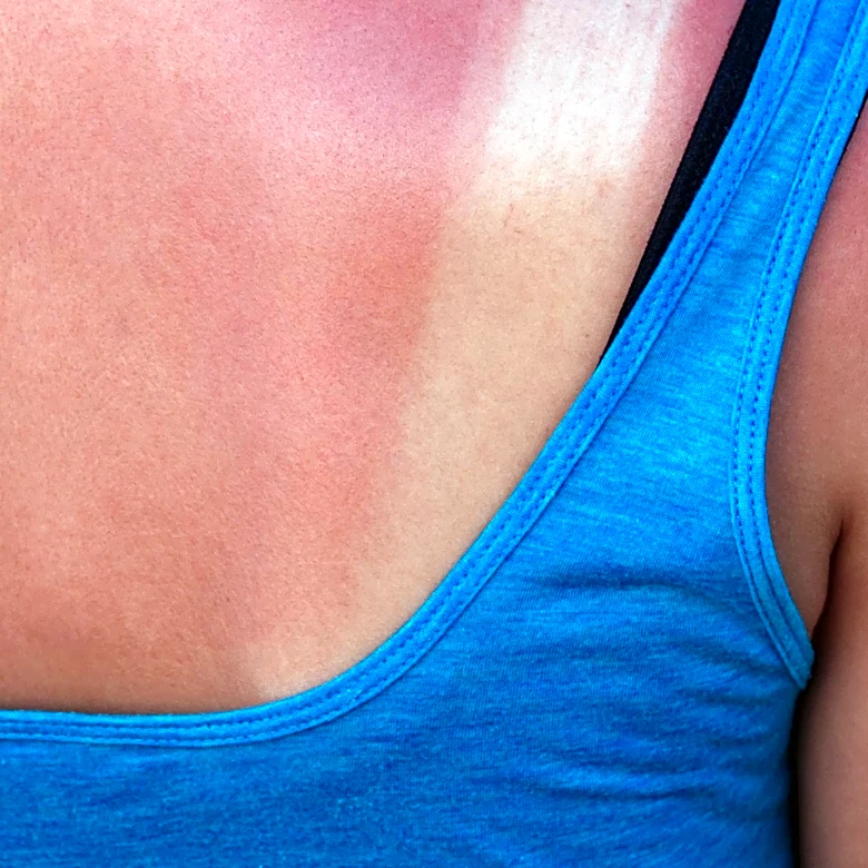 Heat Dome in Western US Poses Severe Health Risks to Millions