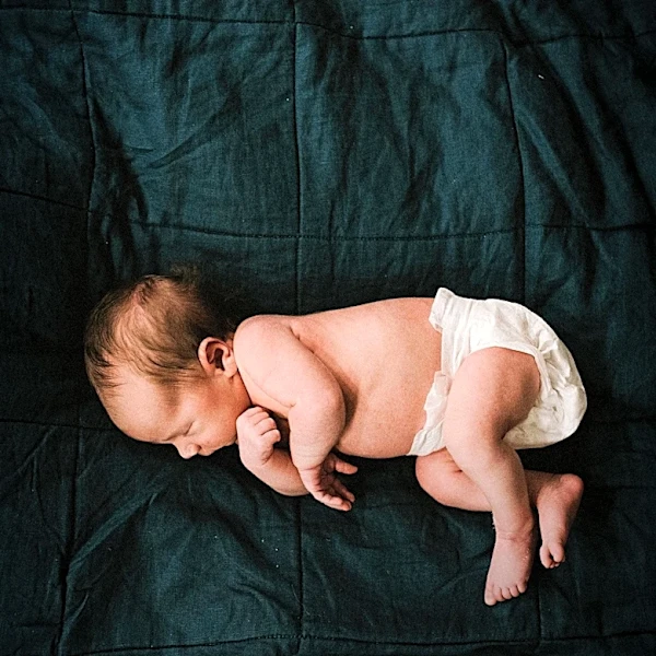Study Links Skipping Vitamin K Shot in Newborns to Increased Bleeding Risk
