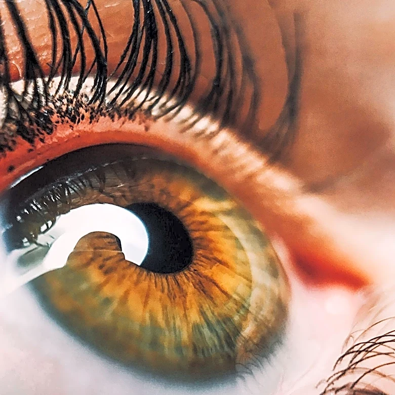Study Maps Diabetic Eye Exam Non-Adherence in Rochester, NY