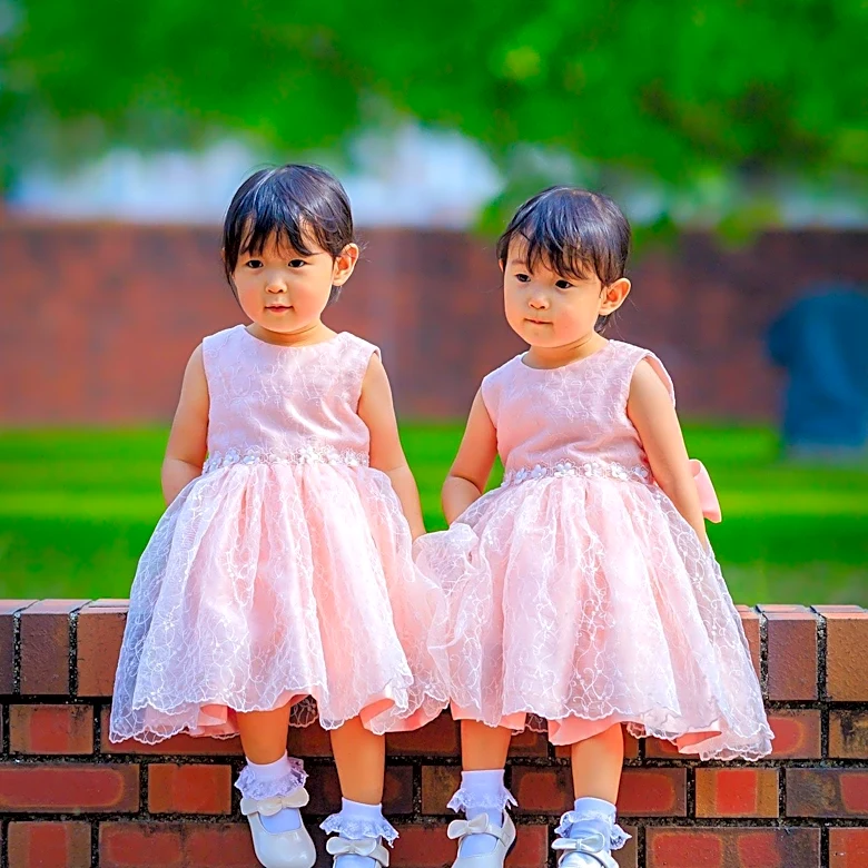 Conjoined Twins Helena and Heloísa Die After Separation Surgery in Brazil