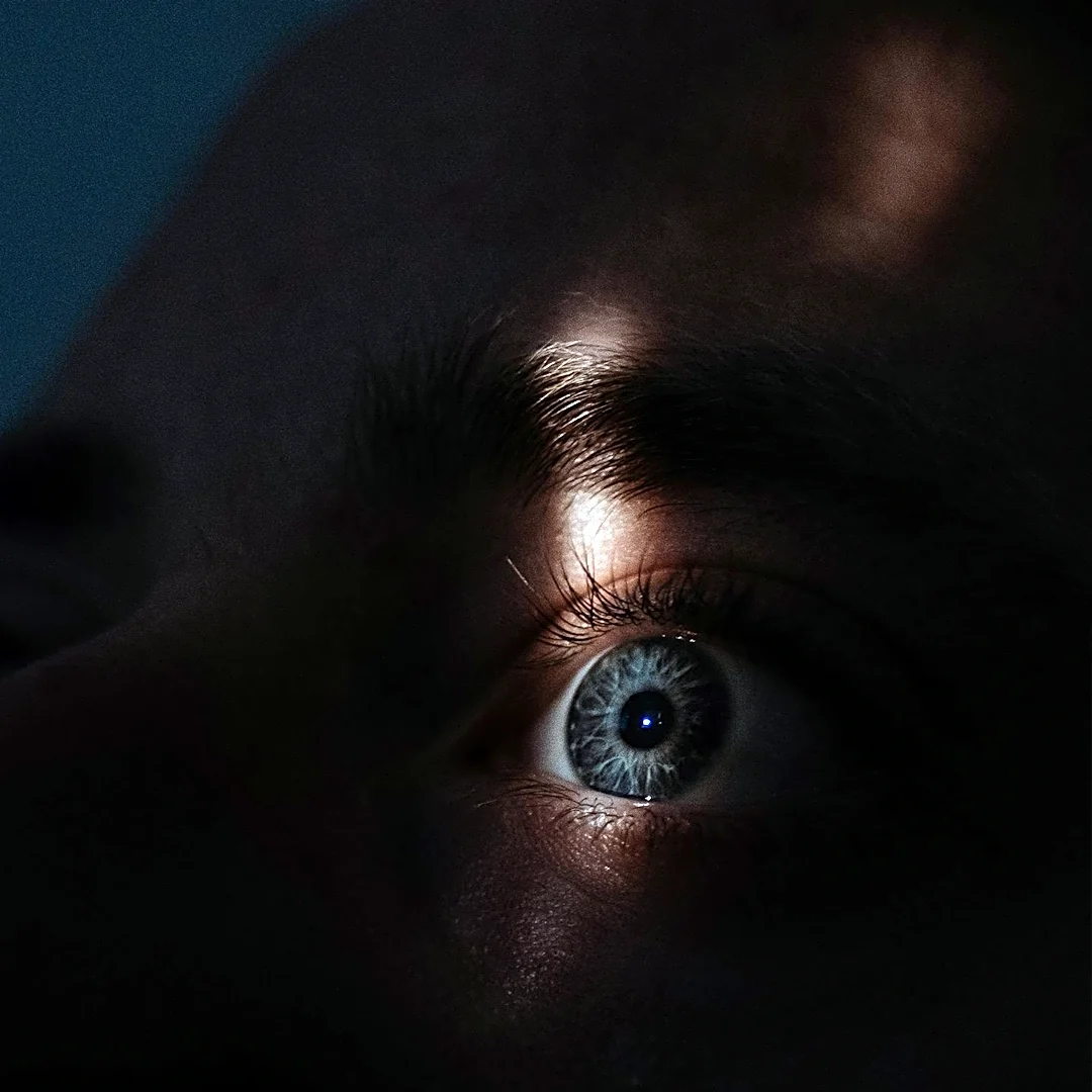 Post-COVID Ocular Symptoms Persist for Years, Suggesting Neuropathic Origin