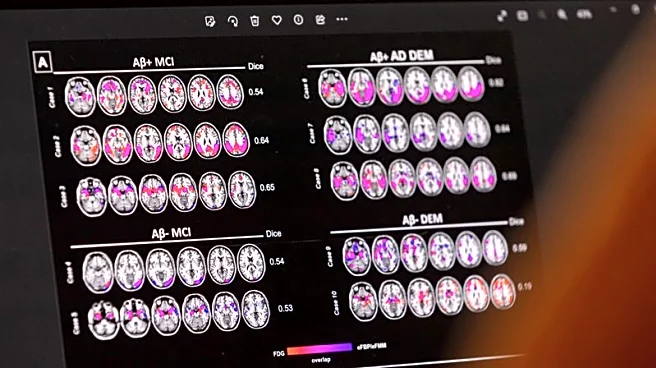 High-stakes Novo Nordisk Alzheimer's studies could yield answers on GLP-1 benefit