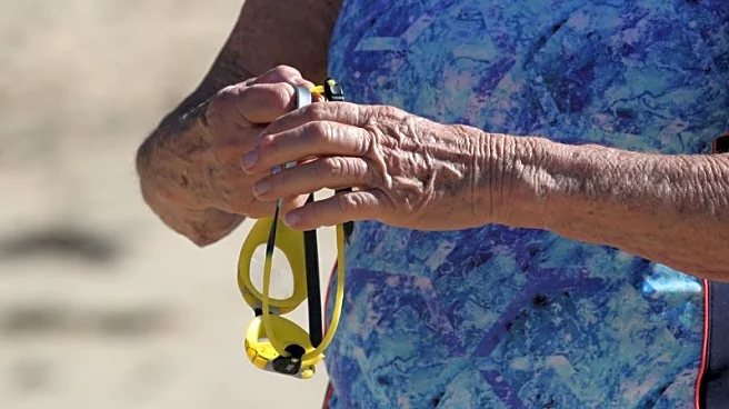 Australia warns its pension industry to be more prepared for wave of retirees