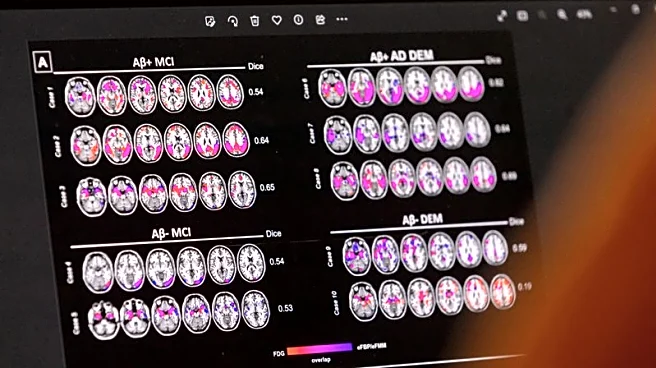 Analysis-Alzheimer's drug hunt learns from cancer fight's multi-target playbook