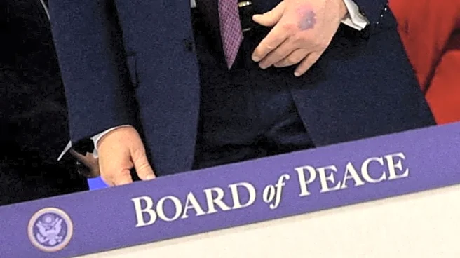 Trump attributes new bruise on hand to aspirin consumption