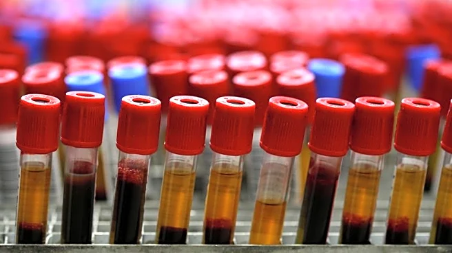 Agilent to acquire Biocare Medical in $950 million all-cash deal