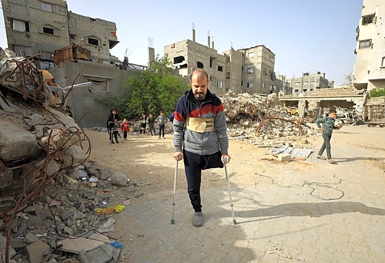 Gaza's war amputees short of prostheses under Israeli restrictions