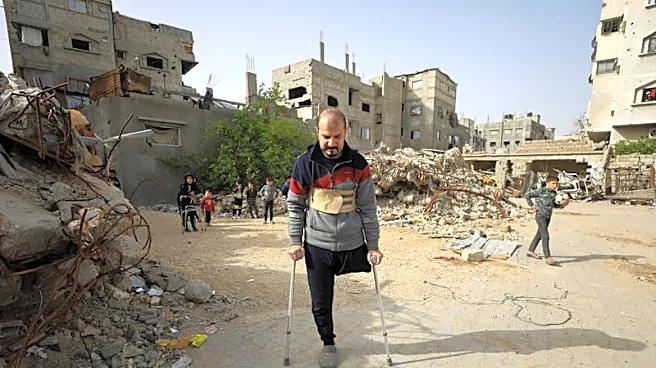 Gaza's war amputees short of prostheses under Israeli restrictions
