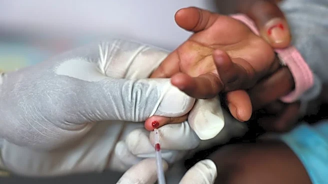 US aid cuts undermine HIV prevention in South Africa, report finds