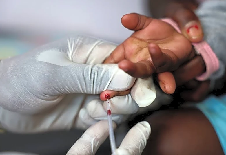 Expert quits US HIV role, rebukes Trump global health approach