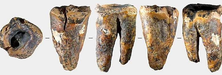 Tooth from Siberian cave reveals Neanderthal dental surgery