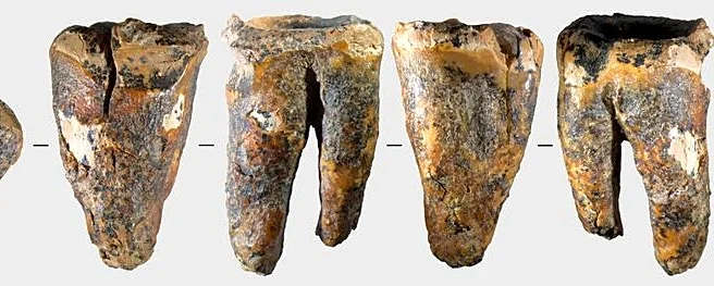 Tooth from Siberian cave reveals Neanderthal dental surgery