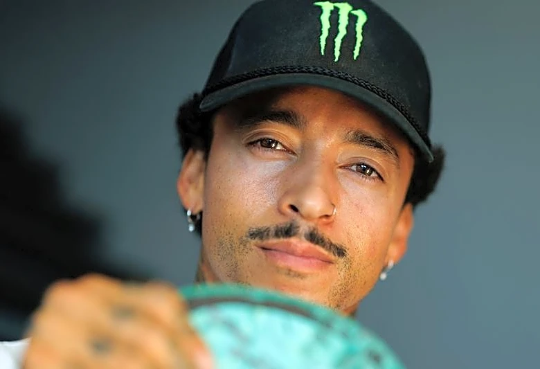 Skateboarding-Huston in hospital with fractured jaw and lacerated kidney