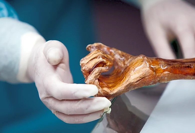 Scientists reveal Ötzi the Iceman's dynamic microbial world