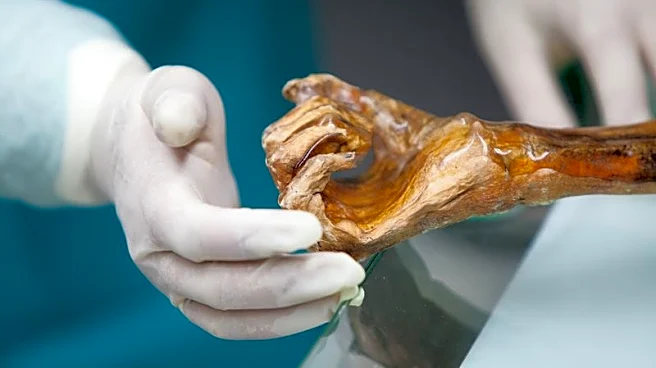 Scientists reveal Ötzi the Iceman's dynamic microbial world
