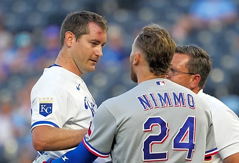 Royals RHP Seth Lugo takes liner off forehead, exits game vs. Rangers