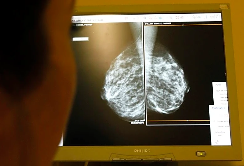 Celcuity shares fall as delayed breast cancer drug launch eclipses first US FDA approval