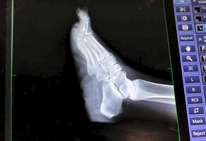 Teledyne to acquire Varex Imaging in $1.1 billion deal