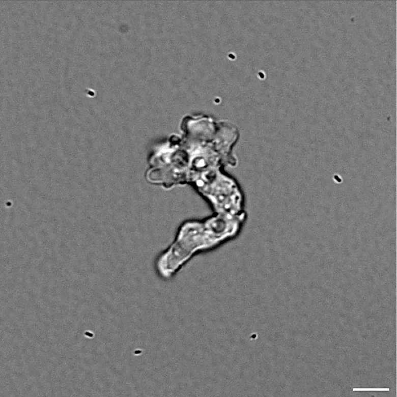 Tenacious hot springs amoeba sets heat-tolerance record