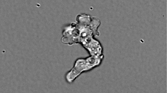 Tenacious hot springs amoeba sets heat-tolerance record